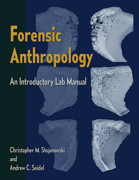 Forensic Anthropology